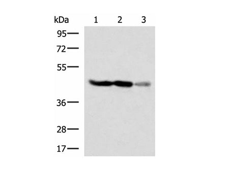 FDFT1 Polyclonal Antibody Reactivity Human