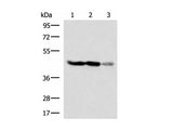 FDFT1 Polyclonal Antibody Reactivity Human