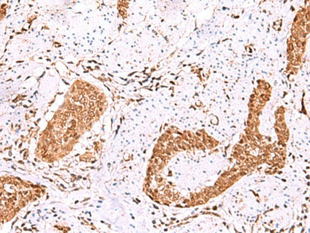 FDPS Polyclonal Antibody Reactivity Human