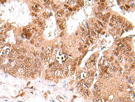 FDPS Polyclonal Antibody Reactivity Human