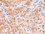 UXS1 Polyclonal Antibody