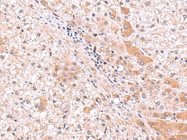 RIC8A Polyclonal Antibody Reactivity Human