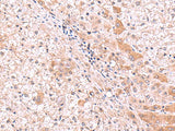 RIC8A Polyclonal Antibody Reactivity Human