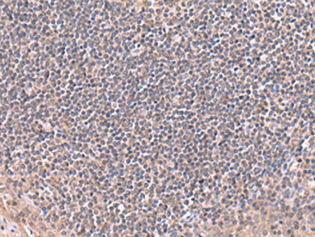 RIC8A Polyclonal Antibody Reactivity Human