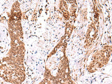 AK9 Polyclonal Antibody Reactivity Human