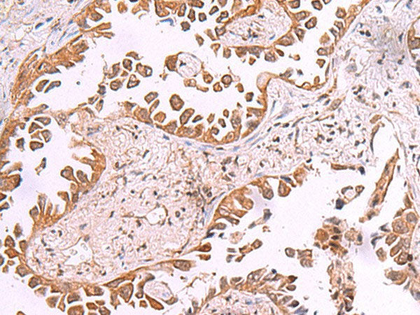 AK9 Polyclonal Antibody Reactivity Human
