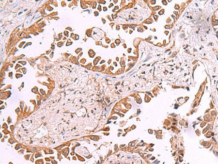 AK9 Polyclonal Antibody Reactivity Human