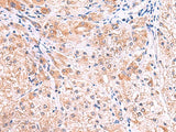 SMPD2 Polyclonal Antibody Reactivity Human