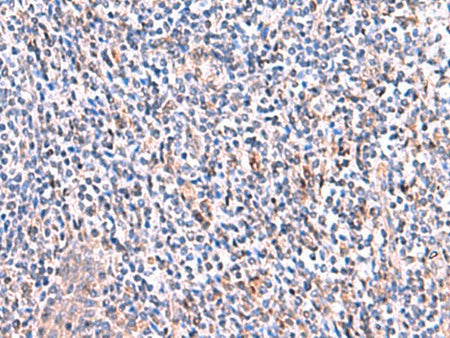 SMPD2 Polyclonal Antibody Reactivity Human