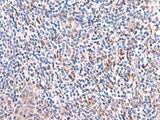 SMPD2 Polyclonal Antibody Reactivity Human