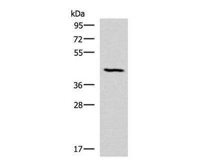 SMPD2 Polyclonal Antibody Reactivity Human