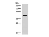SMPD2 Polyclonal Antibody Reactivity Human