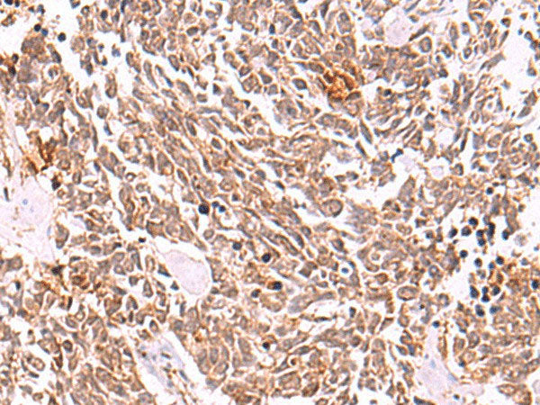 COPS3 Polyclonal Antibody Reactivity Human