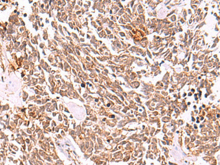 COPS3 Polyclonal Antibody Reactivity Human