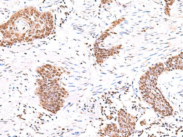 ACTL6B Polyclonal Antibody Reactivity Human