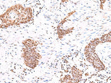ACTL6B Polyclonal Antibody Reactivity Human