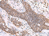SCCPDH Polyclonal Antibody Reactivity Human