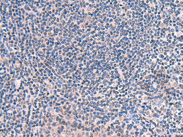 SCCPDH Polyclonal Antibody Reactivity Human