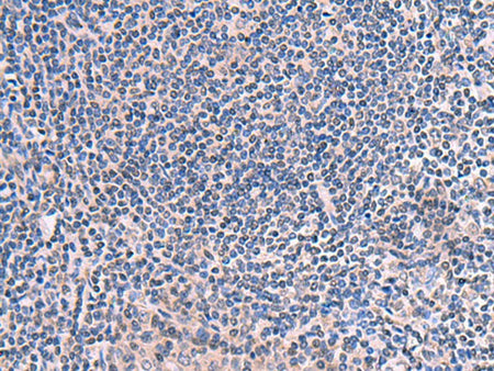 SCCPDH Polyclonal Antibody Reactivity Human