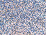 SCCPDH Polyclonal Antibody Reactivity Human