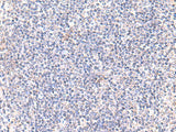 IFT57 Polyclonal Antibody Reactivity Human