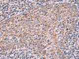 ECSIT Polyclonal Antibody Reactivity Human