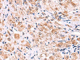 ECSIT Polyclonal Antibody Reactivity Human