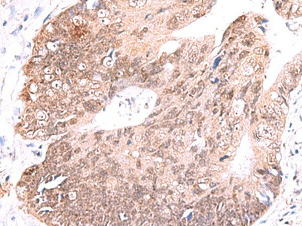 RUSC1 Polyclonal Antibody Reactivity Human