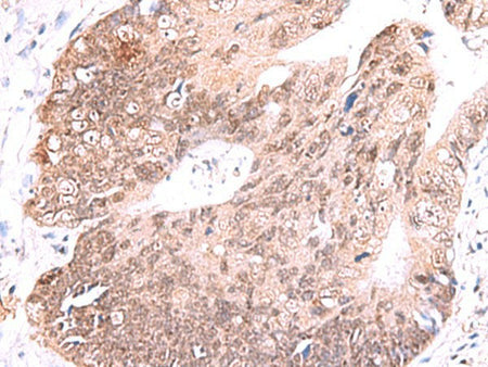 RUSC1 Polyclonal Antibody Reactivity Human