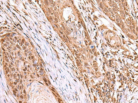 RCOR3 Polyclonal Antibody Reactivity Human