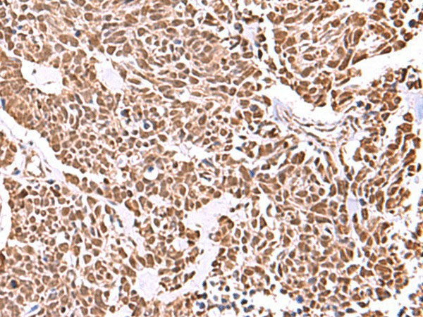 RCOR3 Polyclonal Antibody Reactivity Human