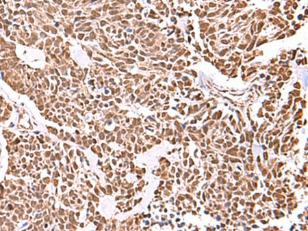RCOR3 Polyclonal Antibody Reactivity Human
