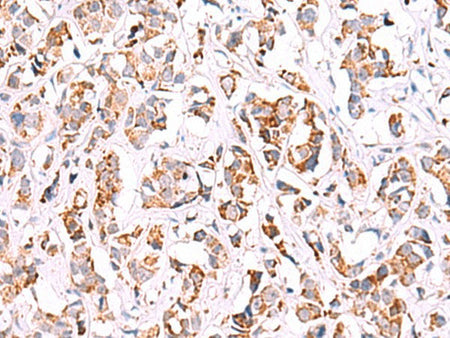 SIGLEC6 Polyclonal Antibody