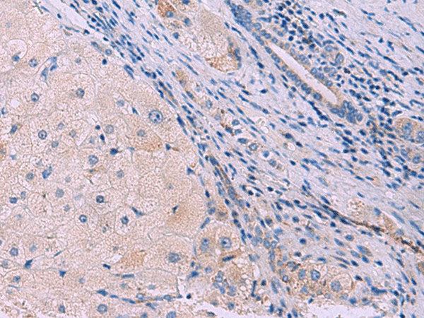 SIGLEC6 Polyclonal Antibody