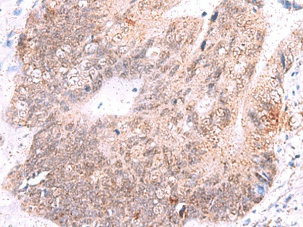 ASTN2 Polyclonal Antibody Reactivity Human