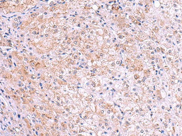 KIR3DL1 Polyclonal Antibody Reactivity Human