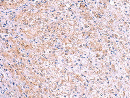 KIR3DL1 Polyclonal Antibody Reactivity Human