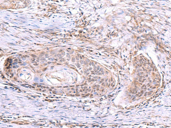 AKAP17A Polyclonal Antibody Reactivity Human