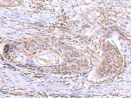 AKAP17A Polyclonal Antibody Reactivity Human