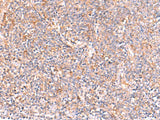 NADK Polyclonal Antibody Reactivity Human