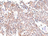 INPP5K Polyclonal Antibody Reactivity Human