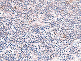 INPP5K Polyclonal Antibody Reactivity Human