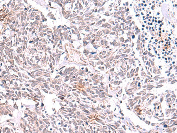 TRMT12 Polyclonal Antibody Reactivity Human