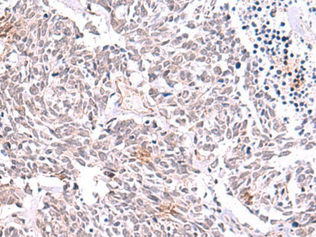TRMT12 Polyclonal Antibody Reactivity Human