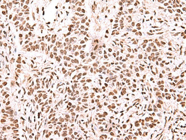 NASP Polyclonal Antibody Reactivity Human