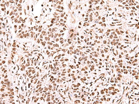 NASP Polyclonal Antibody Reactivity Human