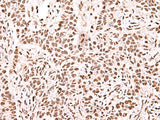 NASP Polyclonal Antibody Reactivity Human
