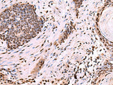 NASP Polyclonal Antibody Reactivity Human