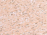 RRP8 Polyclonal Antibody Reactivity Human