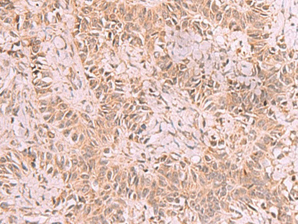 RRP8 Polyclonal Antibody Reactivity Human